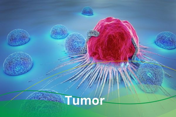 Tumor
