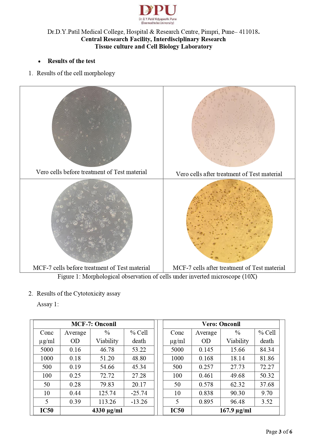 Onconil Capsule–For curing carcinogenic tumours & reducing inflammation